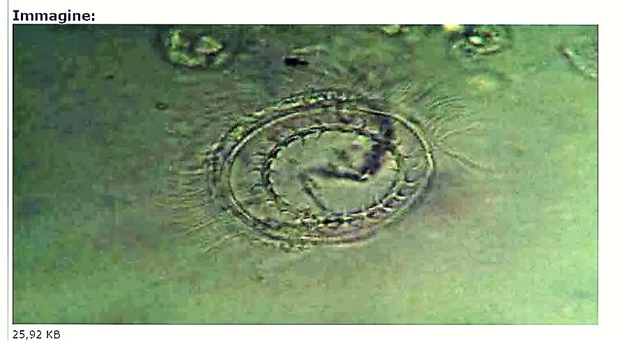 vorticella?